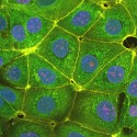 Komórki nowotworu piersi MCF-7