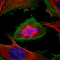 Komórki nowotworu szyjki macicy HeLa