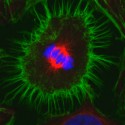 Komórka nowotworu piersi MCF-7 w trakcie podziału mitotycznego, metafaza