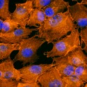 Komórki nowotworu czerniaka A375