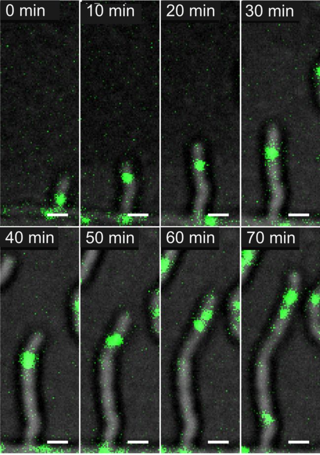 Przykładowe zdjęcia mikroskopowe przedstawiające wzrost strzępki Streptomyces coelicolor.